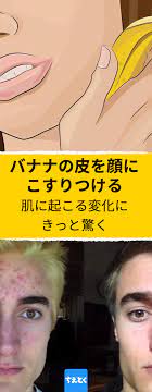 今回は あの嫌なニキビを撃退するためのシンプルでナチュラルな方法をご紹介します 必要なのは バナナの皮です ニキビの悩みを一発で解決してくれるバナナの皮ですが 6通りの使い方があります ちなみに バナナの皮は栄養面で非常に優れています ニキビ 対策