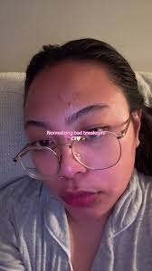 Does Trader Joes Sunscreen Break Out