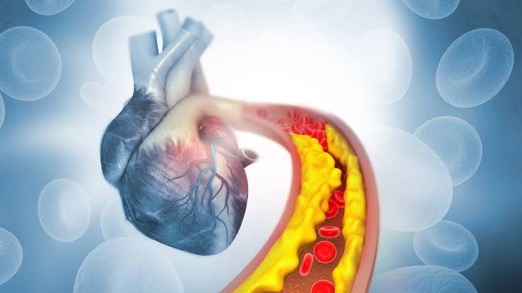 कोलेस्ट्रॉल कैसे कम करें? जीवनशैली में ये 5 सबसे अच्छे बदलाव अपनाएं | हेल्थशॉट्स