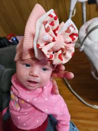 Bison with unique hair fixture comparison