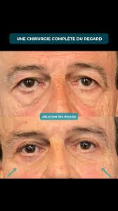 Dr Fyad chirurgien...