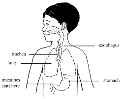 nasogastric tube feeding childrens education materials