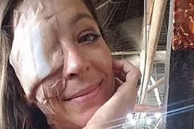 Fundraiser by Stephanie Deni-Iaeger : Eye Surgery