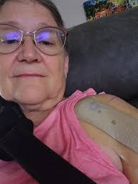 Pain after shoulder replacement surgery