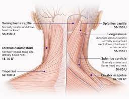 In some cases, it is caused by imbalances in the deep muscles. Anatomy Of Back Of Neck Anatomy Drawing Diagram
