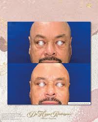 Dr. Hugo Rodriguez Cirugía plástica, estética y Reconstructiva added a new  photo — in Ciudad Juárez,...