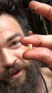 Anyone know any good dentists???😳😂🙌🤘🦷….Kings don’t Quit!!….TUNE in  TONIGHT at 8pm EST for the GRAND FINALE of Naked & Afraid XL 2022: “Next  Level” to find out!!!!…STAY TUNED AND STAY ...