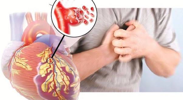 Bí kíp VÀNG giúp ngăn ngừa ĐỘT QUỴ NÃO do bệnh tim mạch gây ra
