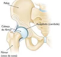 Artroplastia total de quadril (Total Hip Replacement ...