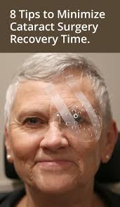 8 Ways To Minimize Cataract Surgery Recovery Time Cataract Surgery Surgery Recovery Cataract Surgery Recovery