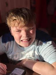 Autism as a unique ability