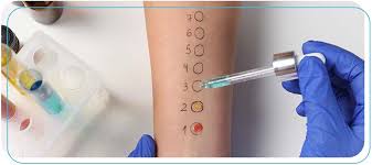 Image result for Patch Testing