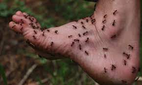 It might take a couple of minutes to days for it to get treated. Red Ant Bites Earth To Kathy