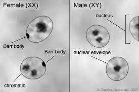 In Simple Terms Can You Explain The Process Of X Chromosome Inactivation And Formation Of Barr Bodies Quora