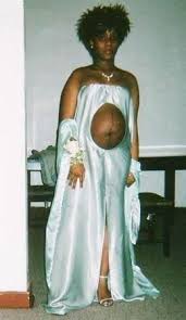 Top 10 Ugliest Wedding Dresses You Will Ever See A Potato Sack Would Be Better Dose Ca Funny Wedding Dresses Weird Wedding Dress Awkward Prom Photos