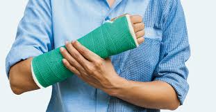Check spelling or type a new query. How Long Do Fractures Take To Heal How Long Will I Be In A Cast Brace Accessortho