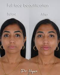 Dr . Lilyan Al-khoury|د. ليليان الخوري‎ (@dr.lilyan.alkhoury) · Dubai, UAE