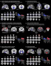 Maybe you would like to learn more about one of these? Significant Neuroanatomical Variation Among Domestic Dog Breeds Journal Of Neuroscience