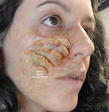 Unpainted Silicone Mushroom Prosthetic (unpainted) Cosplay, LARP, Sfx,  Halloween, the Last of Us