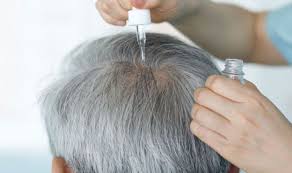 Formulas that include reparative ingredients are key to restoring healthy hair. Hair Loss Treatment Five Of The Best Natural Oils To Stimulate Hair Growth Toysmatrix