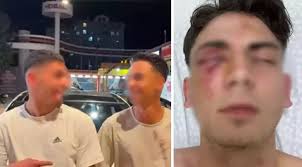 They blinded him by beating him with clubs and recorded a video with blood 