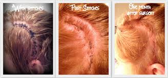 There are several natural ways you can completely get rid of bed bugs in hair. Can Bed Bugs Live In Hair Extensions Minimalist Dog Bed