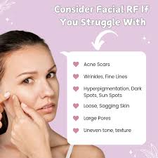 Rf skin tightening treatment for loose skin! . This is FIRST treatment  only! . You can see immediate tightening but best results are seen after 6  treatments!! 6-8 treatments are recommended to