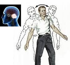 Image result for Ataxia