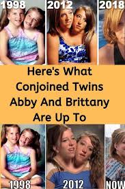 Here S What Conjoined Twins Abby And Brittany Are Up To In 2020 Famous Twins Conjoined Twins Fun Facts