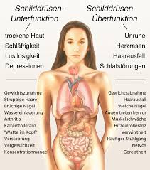 Hinweise Auf Hashimoto Menschlicher Korper Anatomie Anatomie Lernen Anatomie Korper