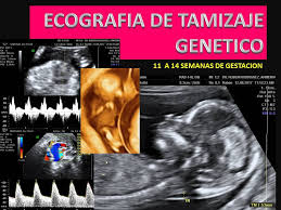 Ecografias 3D - 4D Armenia. 7342522 - Home | Facebook