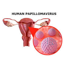 Image result for genital warts