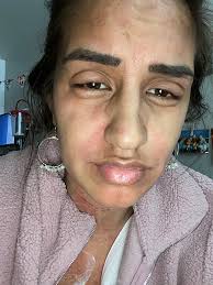 I love my body' — Utah's 'cancer dancer' is still fighting disease and,  now, cruel online comments