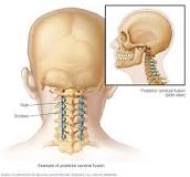 Image result for what does medicare pay for a cervical spinal fusion