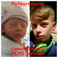 Congenital heart disease (or CHD) is a war much like the war in the Middle  East. You have to have a plan, it's good to have a strategy also. The  operating table