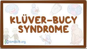 Kluver Bucy Syndrome Skillmd