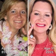 This is the most amazing transformation I've seen yet. She uses the  Anti-aging skin care set and added in the the Bakuchiol serum. What a  difference in only 6 months WOW 🤯