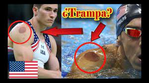 Luisito pie medallista olímpico comenta como fue su preparación en los juegos olímpicos rio 2016. Accidentes Que Ocurrieron En Los Juegos Olimpicos Dos Fallecidos En Diferentes Accidentes De Transito Noticias De Quito La Hora Noticias De Ecuador Sus Provincias Y El Mundo El Unico Antecedente