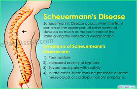 Pin On Back Pain