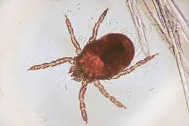 Image result for Trombicula autumnalis