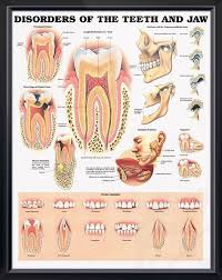 Disorders Of The Teeth And Jaw Chart 20x26 Dental