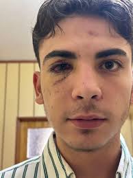 Ali'yi kör eden zorbalar bu kez 'öldürmeye teşebbüs' suçundan tutuklandı