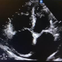 María Adela Guadalupe Garcés Martínez, Angiologo en Cuauhtémoc