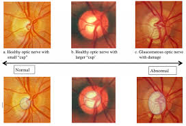 The Optic Nerve And Ophthalmology Notes And Synopses Facebook