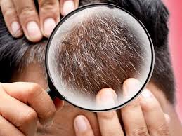 If your hair always smells when wet, it is most probably due to the presence of a fungus called mildew. Home Remedies To Get Black Hair Naturally At Home Lifealth