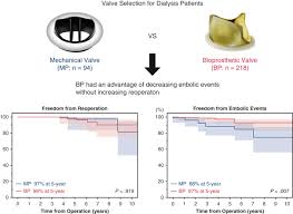 Tidur bareng ama cewek bandung malah ke enakan. Outcomes Of Valve Replacement With Mechanical Prosthesis Versus Bioprosthesis In Dialysis Patients A 16 Year Multicenter Experience The Journal Of Thoracic And Cardiovascular Surgery