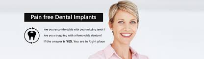 Mar 19, 2021 · it may even be possible to get free dental implants by volunteering for a clinical trial or approaching a dental school, but these opportunities are few and far between. Dental Implants In Dubai Specialist Implantologist In Dubai
