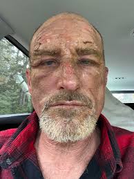 Survivor of deadly nightclub fire finds love and fatherhood