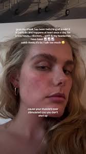 TikTok Help for Cheek Twitching & Headaches! #Health #Facetwitch