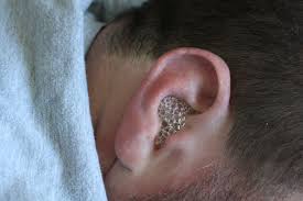 Cat Itchy Skin Home Remedy Earache Remedies Cleaning Your Ears Hydrogen Peroxide Ear